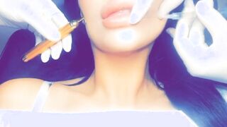 Lauren getting her lips filled