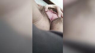 My clit and labia are naturally huge
